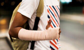 What To Do After A Burn Injury In New York 
